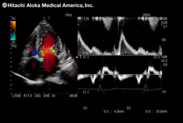 1573345047801643.jpg 2.jpg