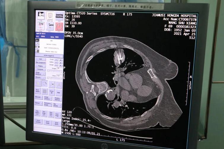 1621469052896468.jpg 3.jpg