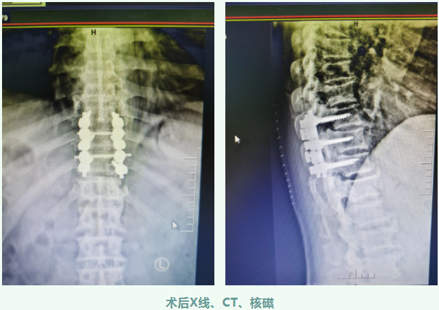 1672034590557867.png 05.png